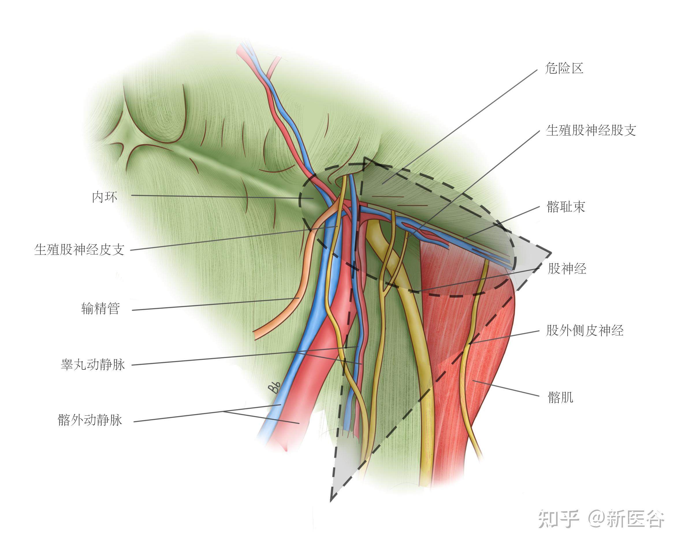 半月线疝位置图片图片