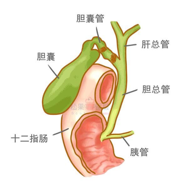 肝内胆管图片清晰图片图片
