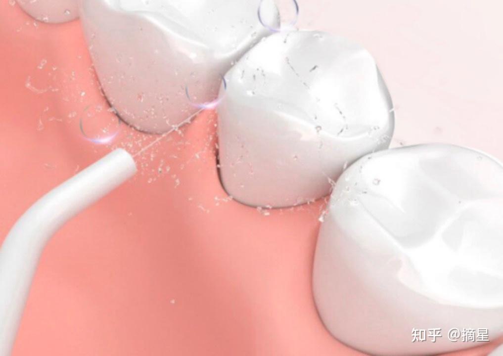 水牙线有必要买吗口腔博主科普利弊危害