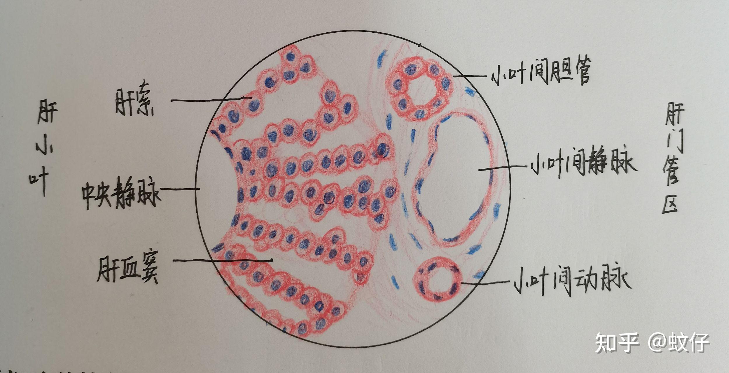 肝细胞水肿手绘红蓝图图片