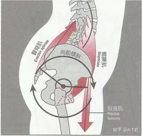 ②共同完成骨盆後傾運動的:臀大肌,膕繩肌,腹肌等.