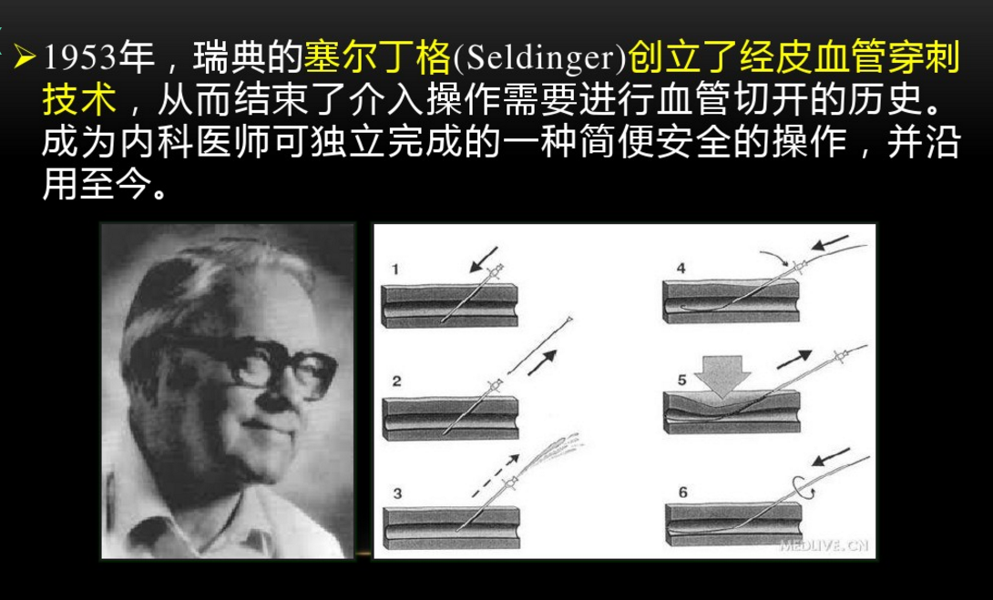 seldinger图片