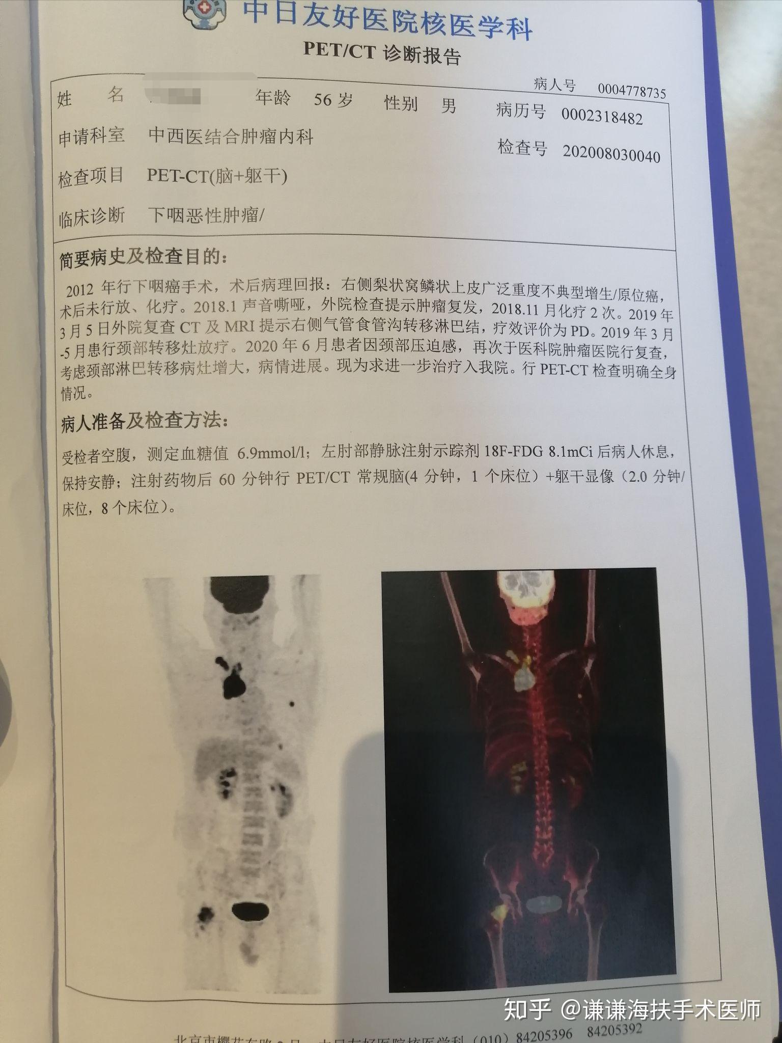 陈谦主任科普之疑难肿瘤病例