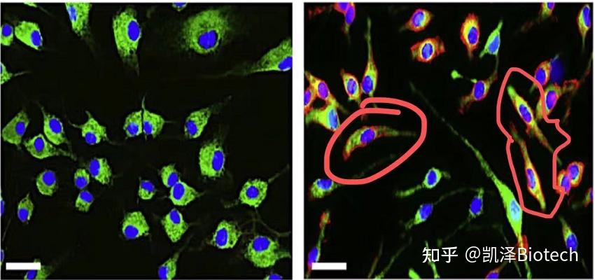 巨噬细胞m1m2历时2年硬干货分享