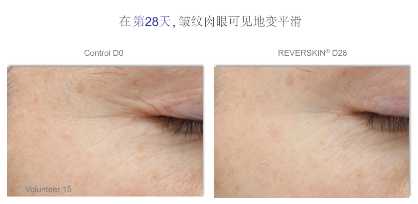 facelabx建议你从今天开始做个厚脸皮皮肤厚度