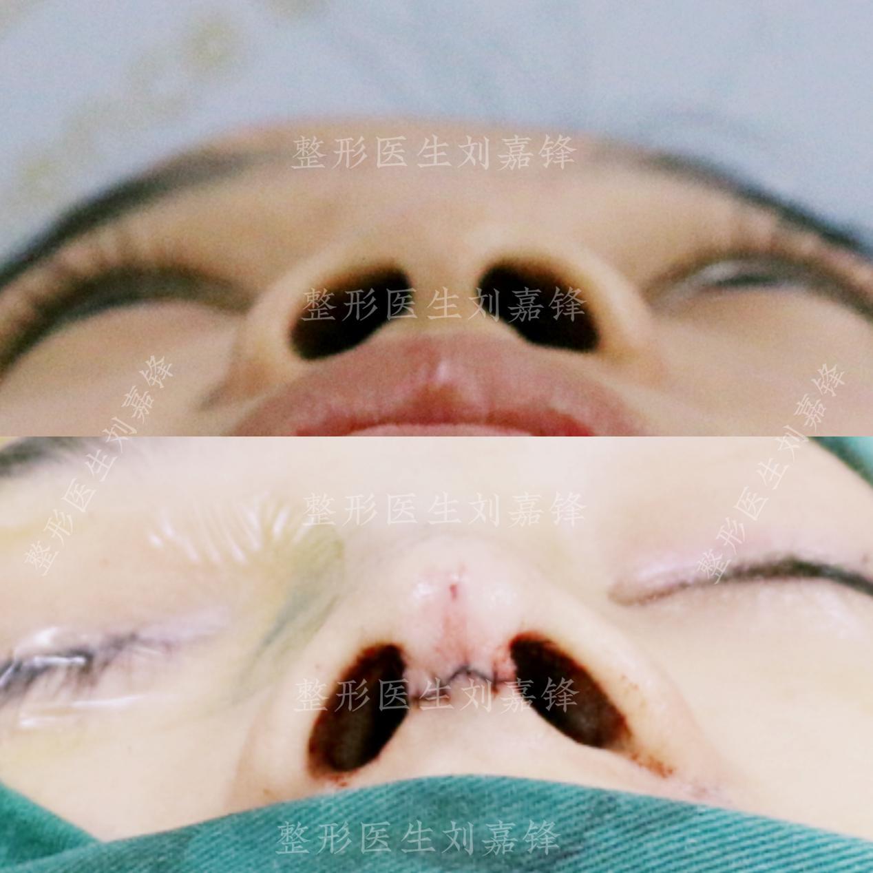 v2-3331db20ff60cd425c9ebf895c6dcd2e_r.jpg