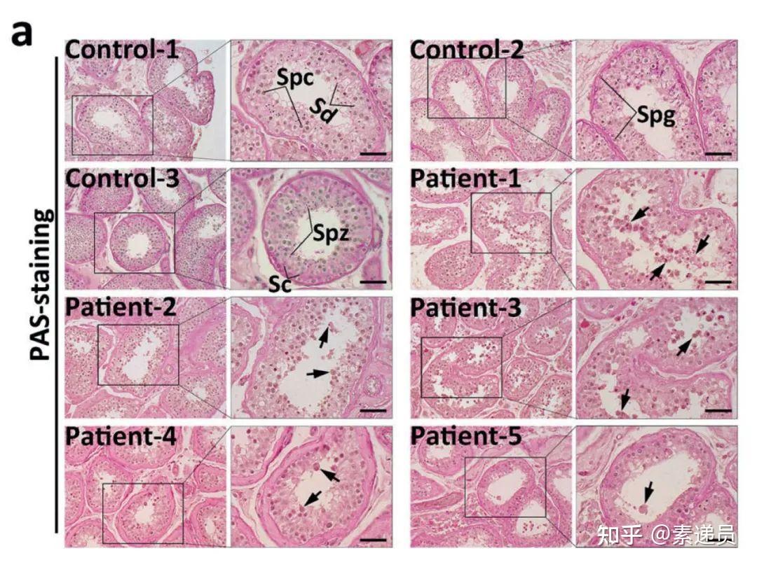 图片引自 ma x et al cell mol immunol.