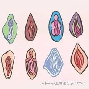 女性私密整形