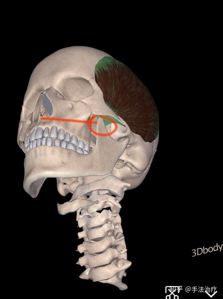 偏头疼的原因之一颞肌损伤