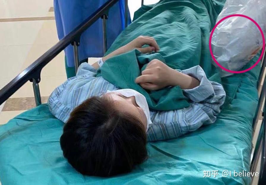 室间隔缺损修补手术正中开胸手术记录