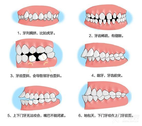 牙齿面相学图解图片