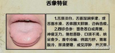 中医舌诊详解大全(独家讲义) - 知乎