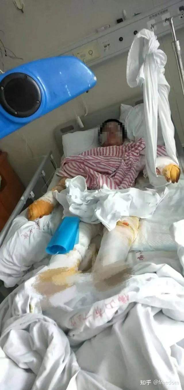 佛山男子求爱遭拒后，向女子泼硫酸并捅刺数十刀，已被执行死刑！ - 知乎