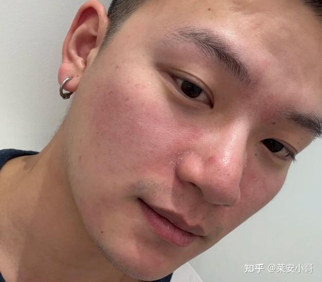 男士护肤品_油皮控油水乳推荐_男士水乳选择指南