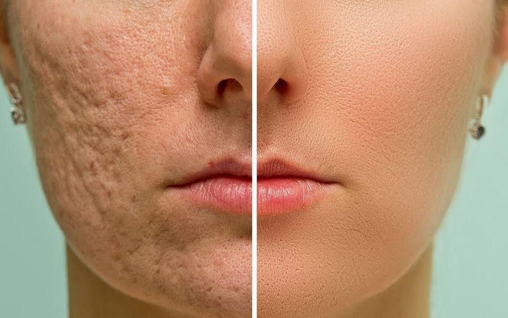 如何修复损伤的肌肤