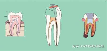 v2-34aba94fddc91f91330eba6872eb4e22_r.jpg