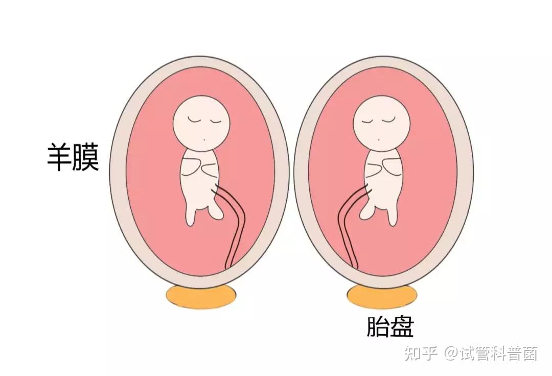 双胞胎有什么风险 - 知乎