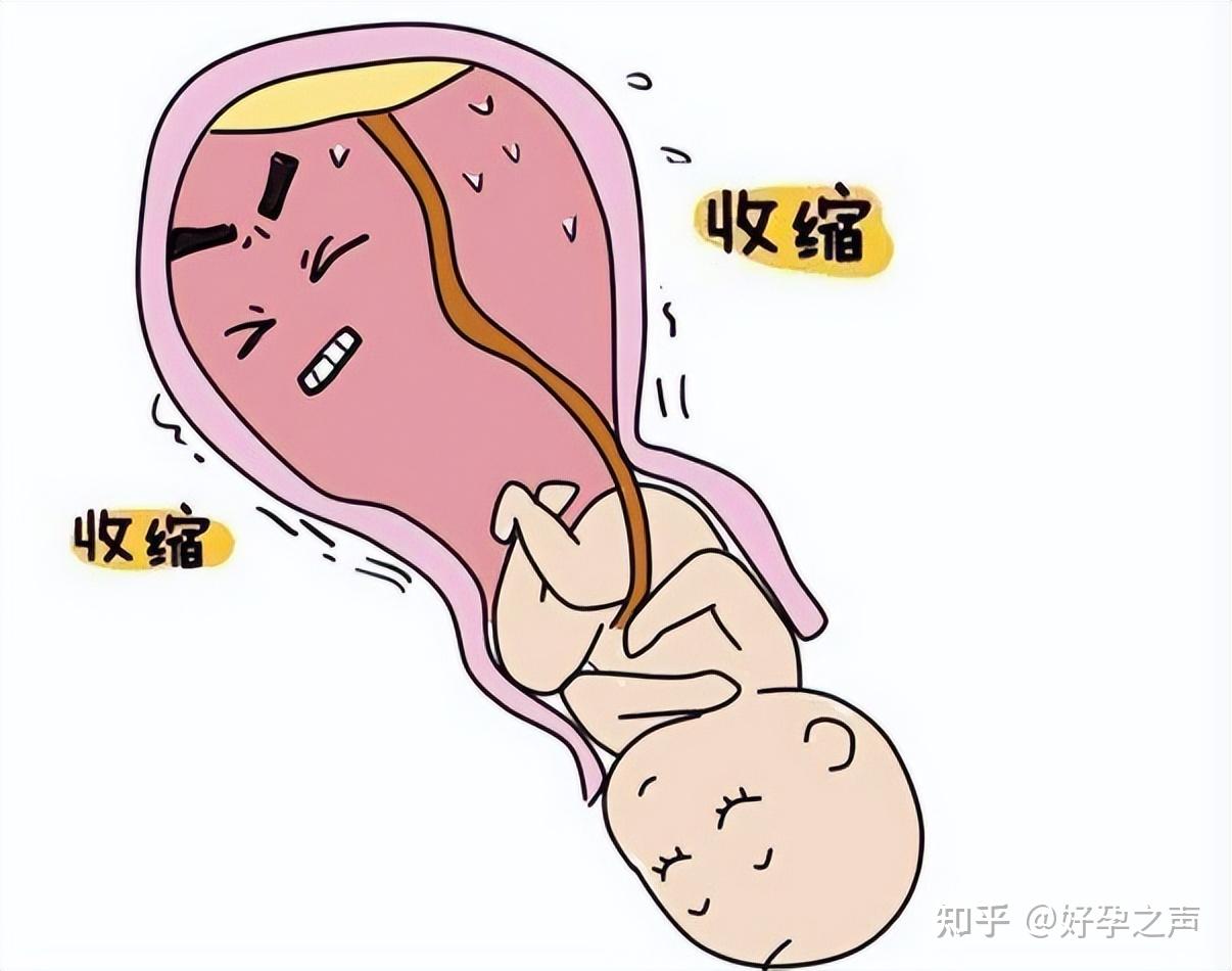 首先需要有明确的多次中晚期妊娠自然流产史,同时非孕期行宫颈机能