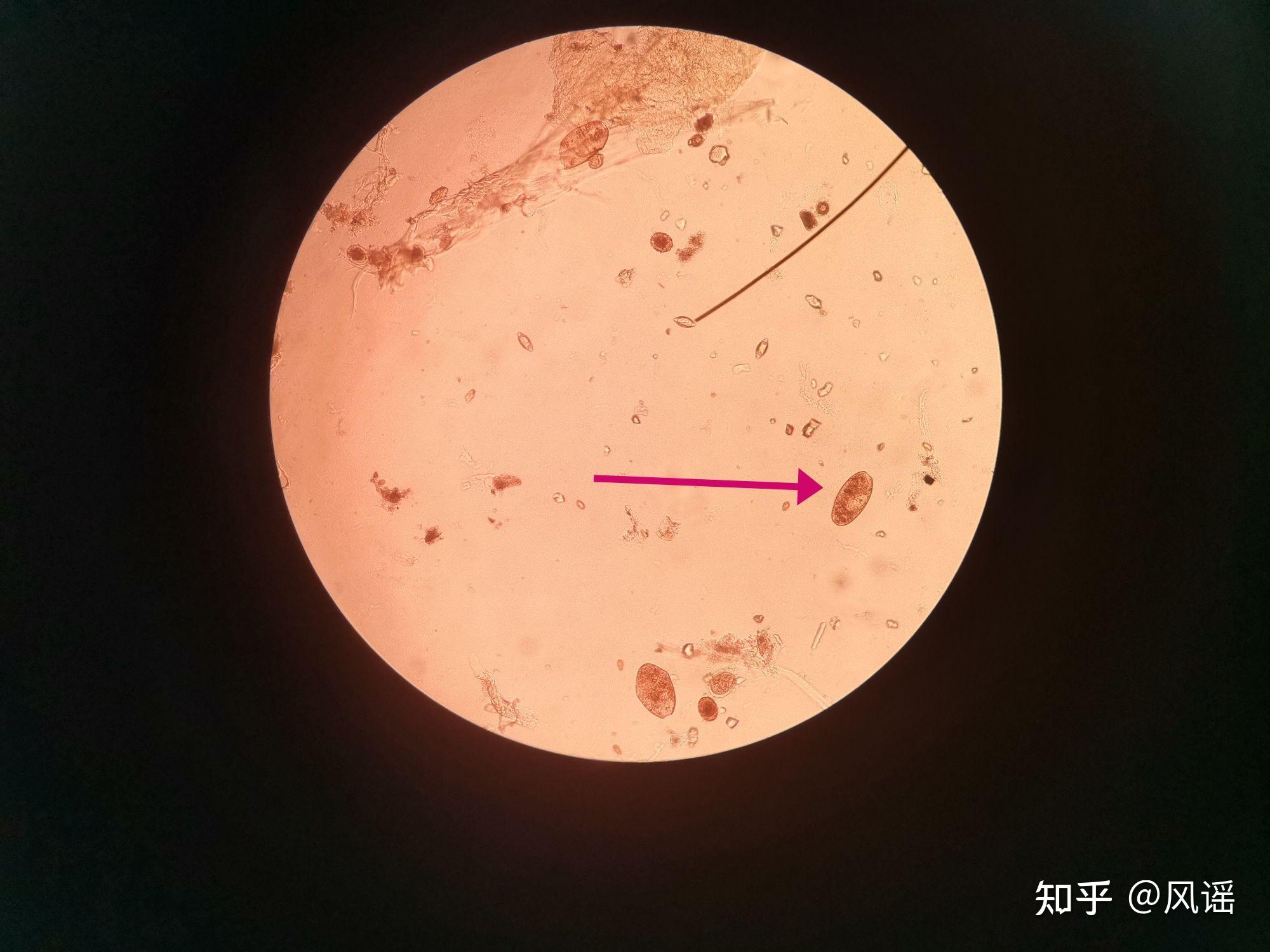 肠吸虫卵手绘图片图片