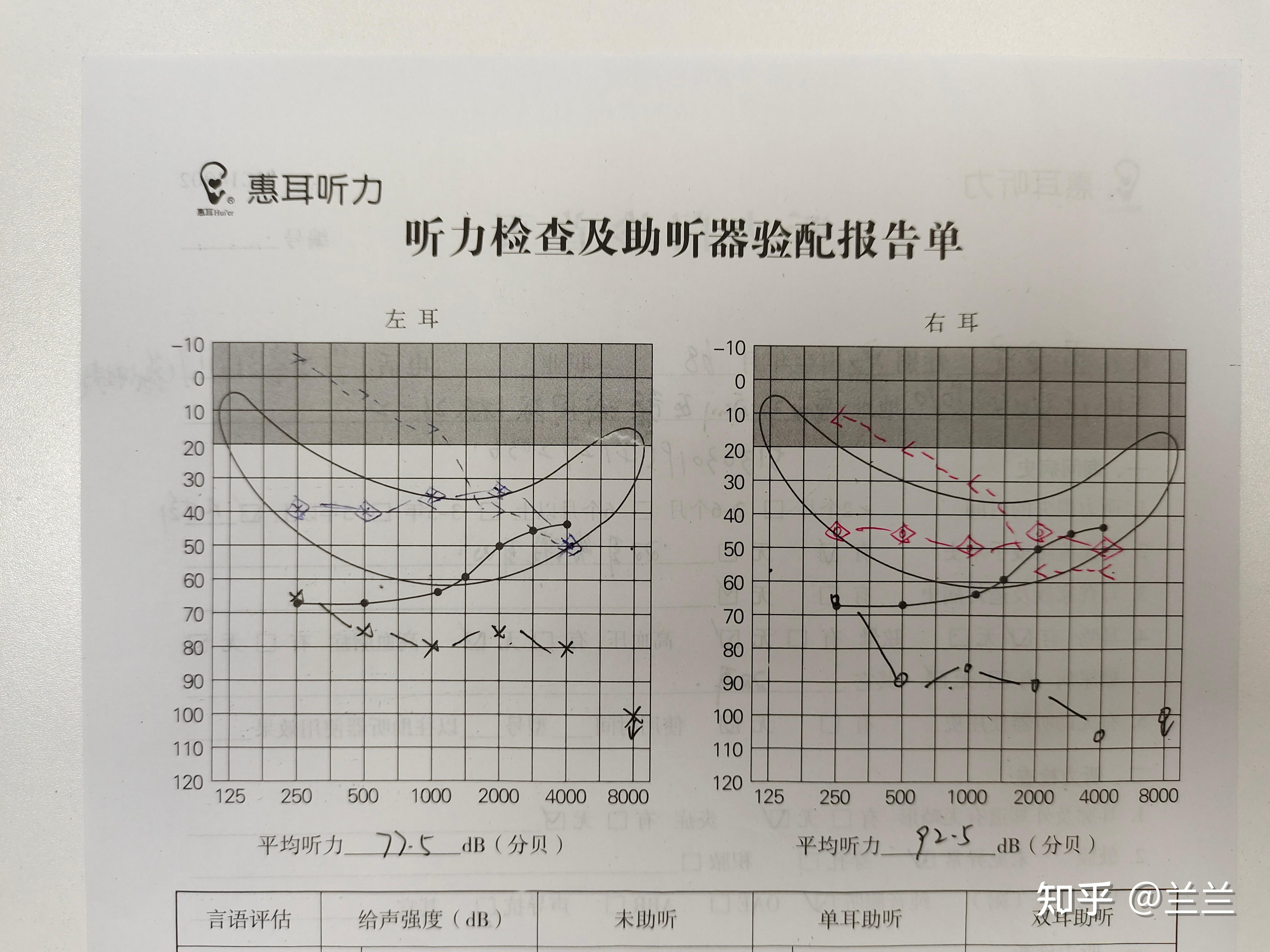 戴助听器对耳朵好吗?