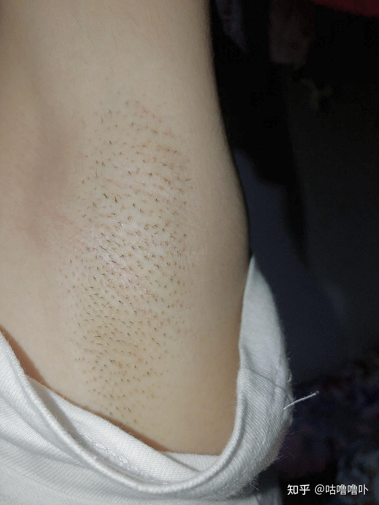 网上那些不是很知名,但是很好用的脱毛膏有哪些?