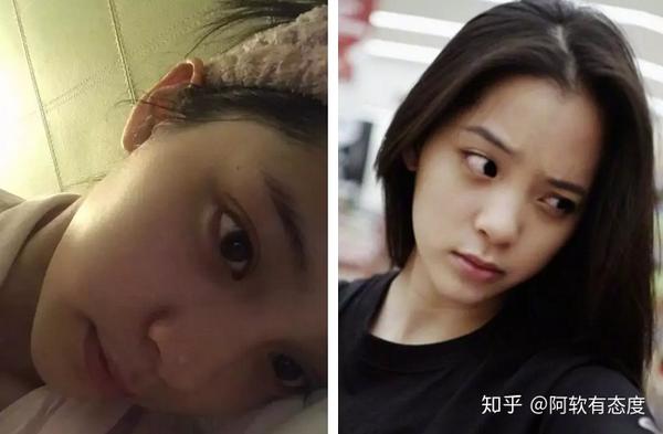 要睡多久能把黑眼圈睡没 知乎 阿软有态度 2019 12 22 这个问题我会答 举手举高高 我就是那个没有国宝的命 却拥有国宝同款黑眼圈 明明已经好久没熬夜 黑眼圈还是很重 用了天价眼霜 黑眼圈依旧除不掉的人 眼睛下方的那一圈乌黑 让人看