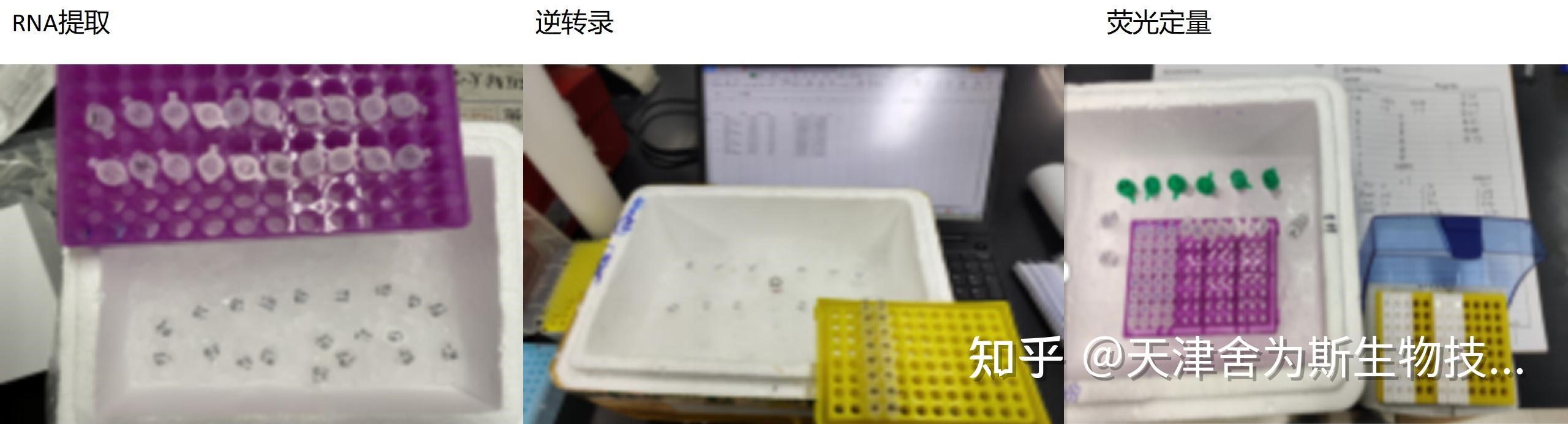 干货分享|全血样本RT-PCR实验技巧、注意事项及内参基因选择 - 知乎