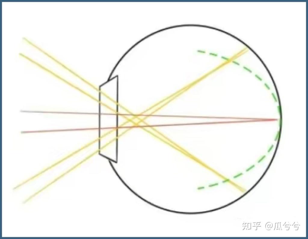 ok镜的原理图片