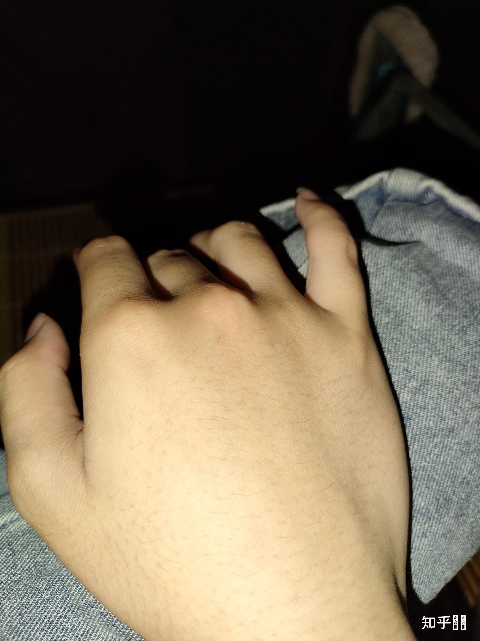 女生长浓密手毛是一种什么样的体验