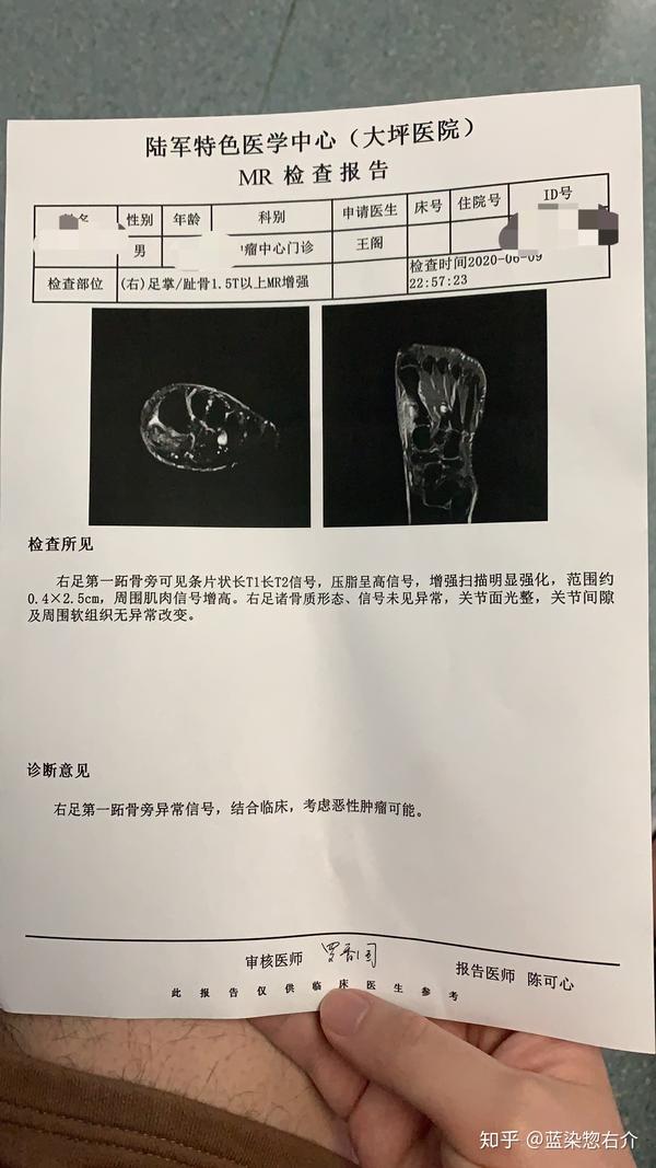 我vs滑膜肉瘤的日记4