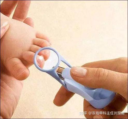 深圳鹏程医院关注剪了大半辈子指甲你告诉我剪错了