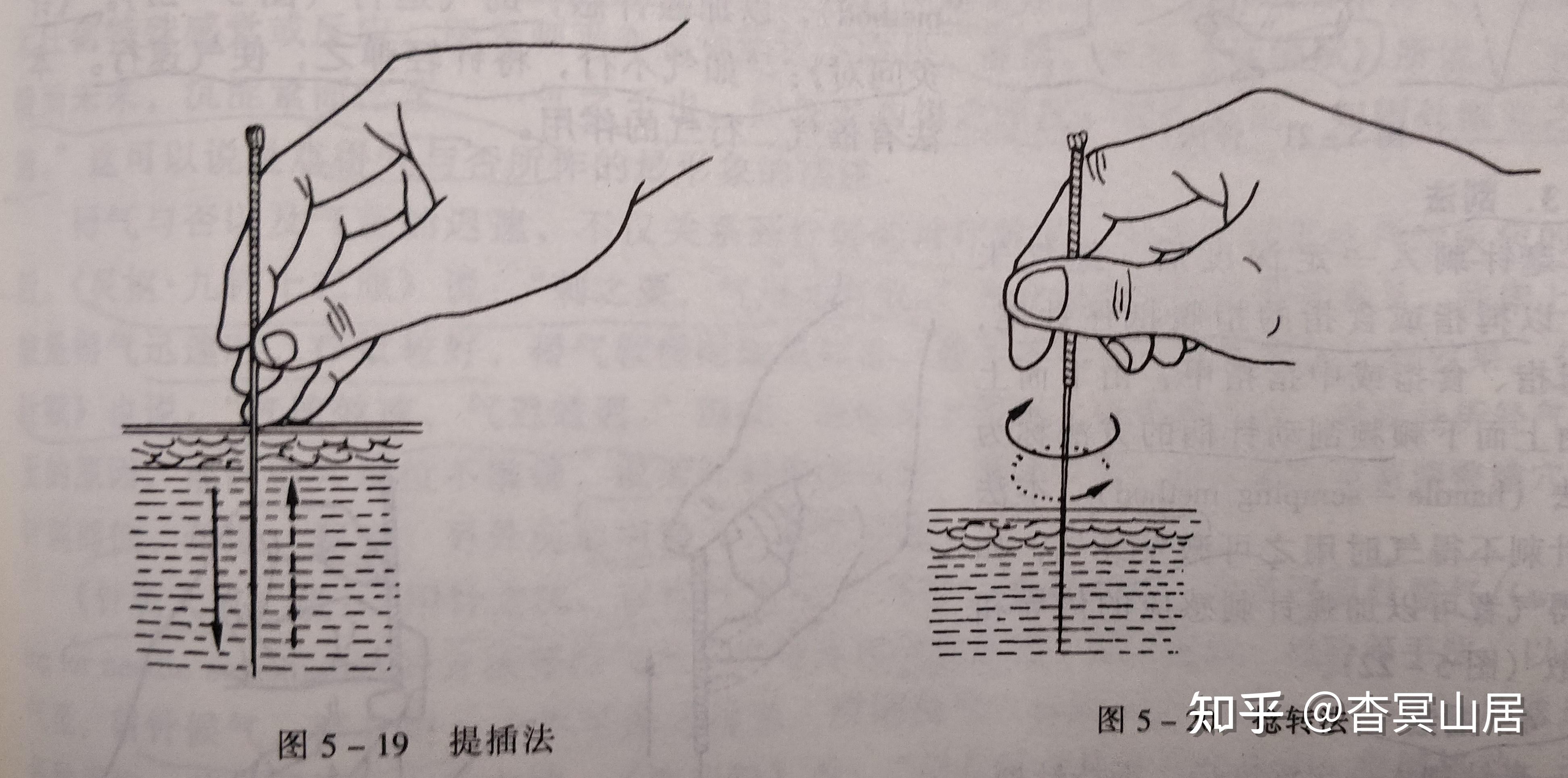 笔记摘要——针灸技术:毫针刺法、补泻原则与灸法概要 - 知乎