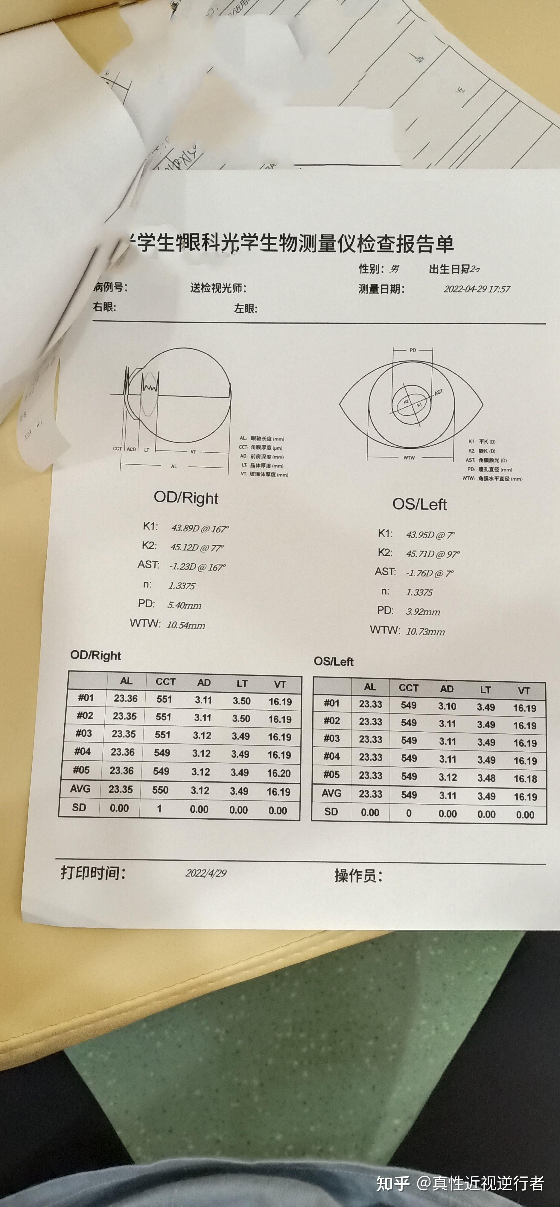 為了對比,我放上之前兩次眼軸測量數據.左眼眼軸長度23.