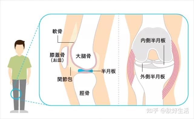 半月板撕裂怎麼治療最好關節肽對半月板的養護作用