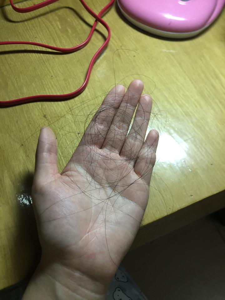 维生素B6,胱氨酸,鱼肝油一起吃可以治疗脱发吗