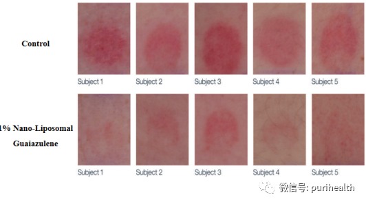 PuriActives®愈创薁纳米脂质体 - 知乎