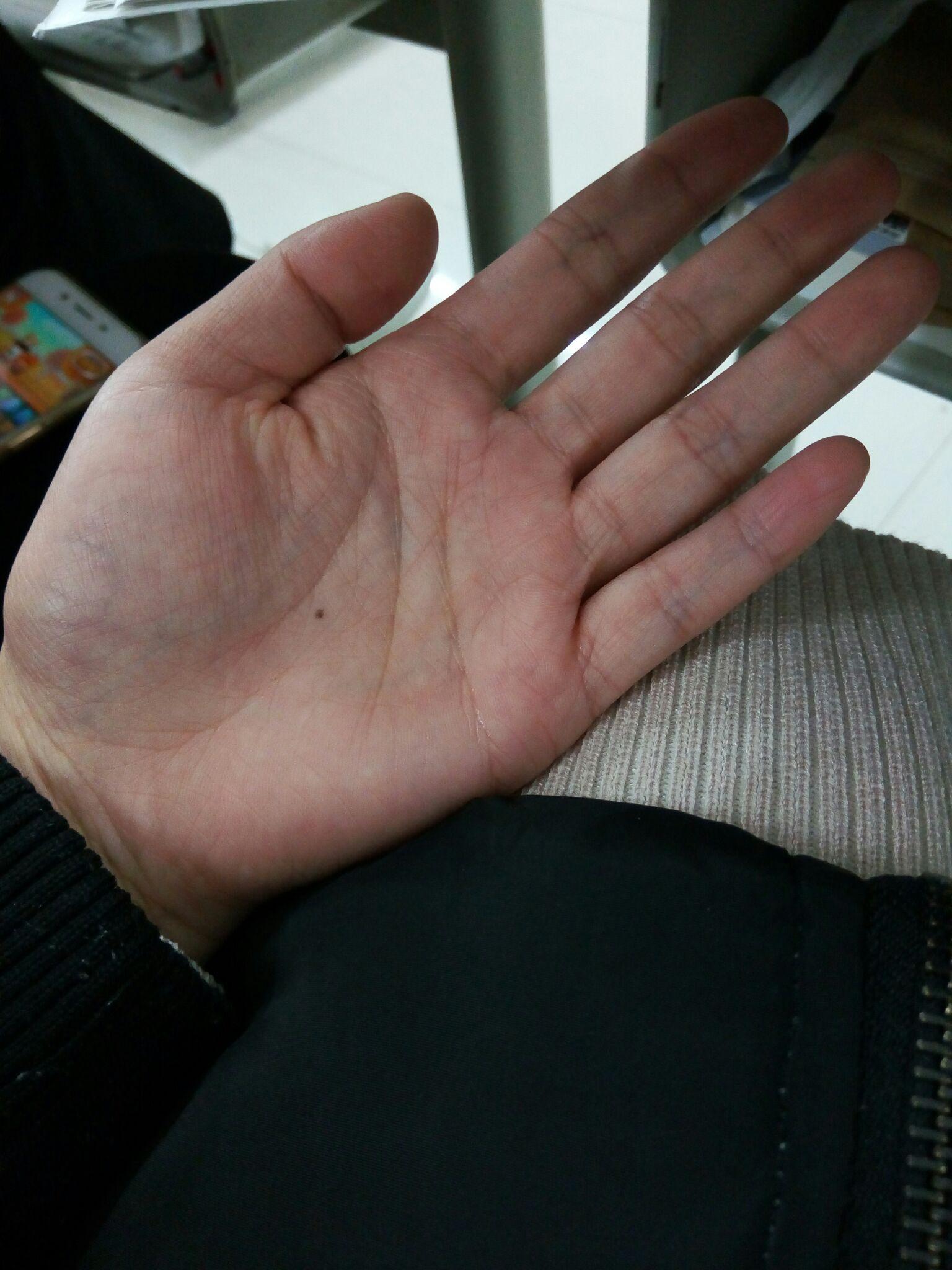 我的左手掌心有颗痣突然很想找到右手掌心相同位置也有痣的人