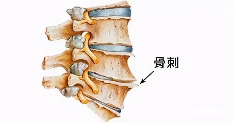 农村土偏方治腰椎间盘突出,骨质增生,肩周炎祖传膏药公布于众,贡献