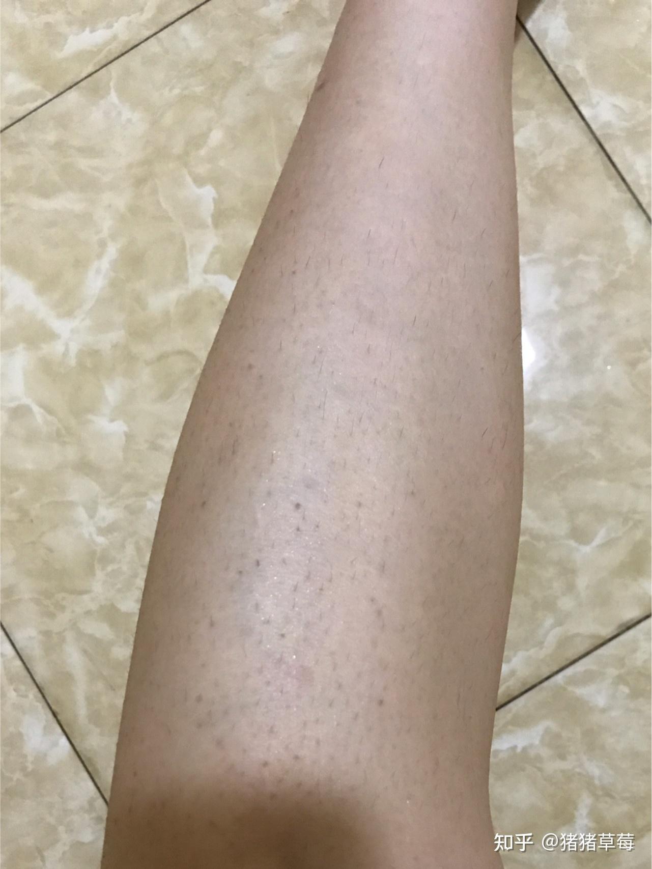 什么牌子的脱毛膏脱完没有黑点?