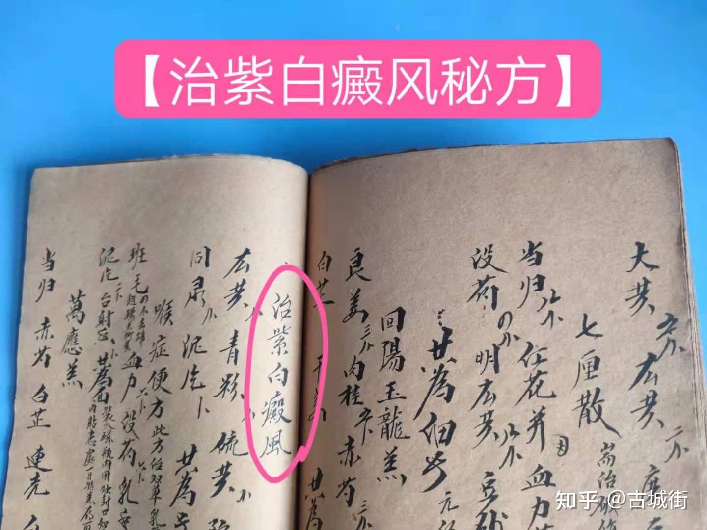 陽痿方主治陰痿方治禿瘡方治紫白癜風秘方珊瑚紫金膏能洽72症眼疾等