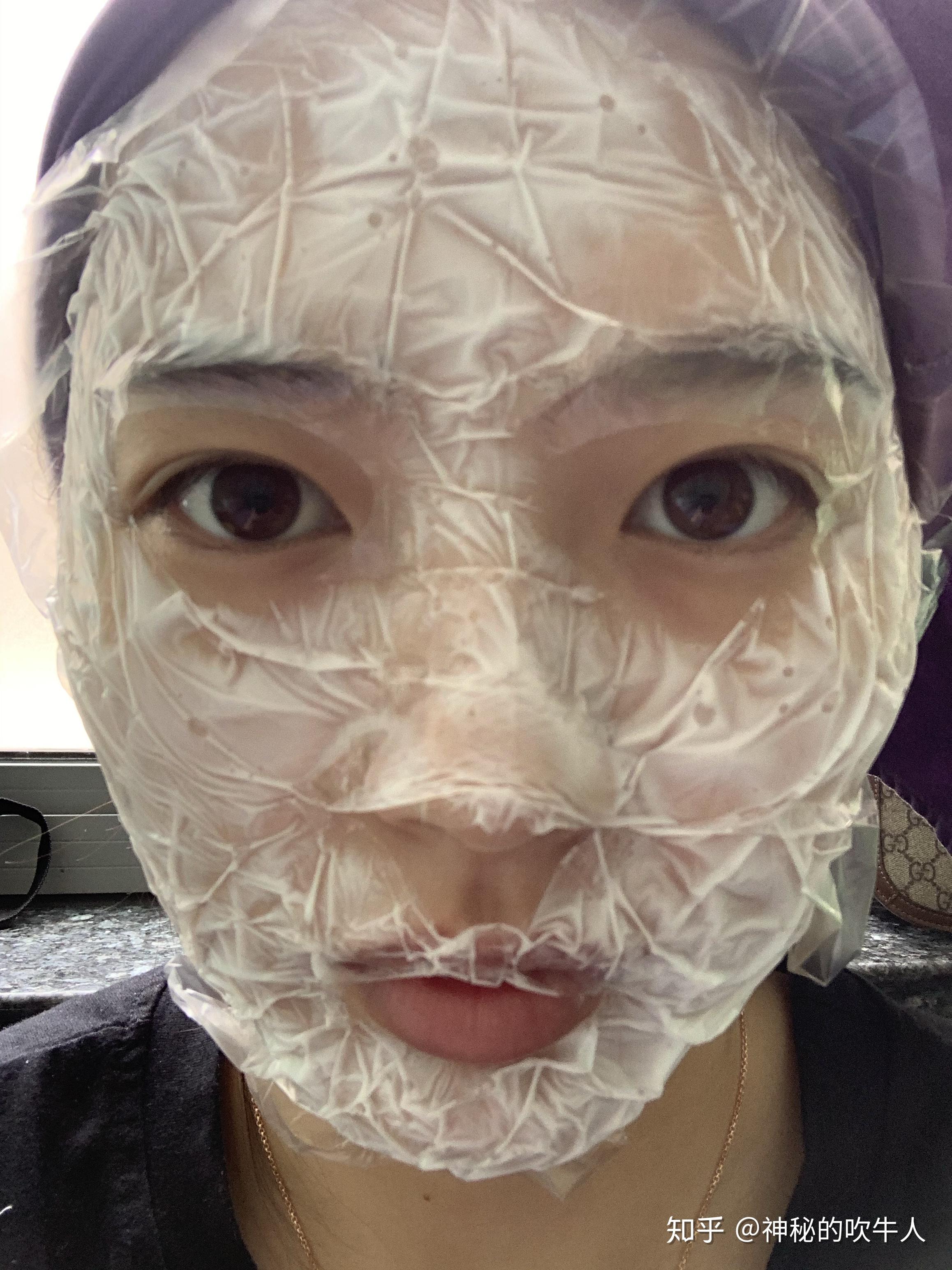 第一次打水光针后感 - 知乎