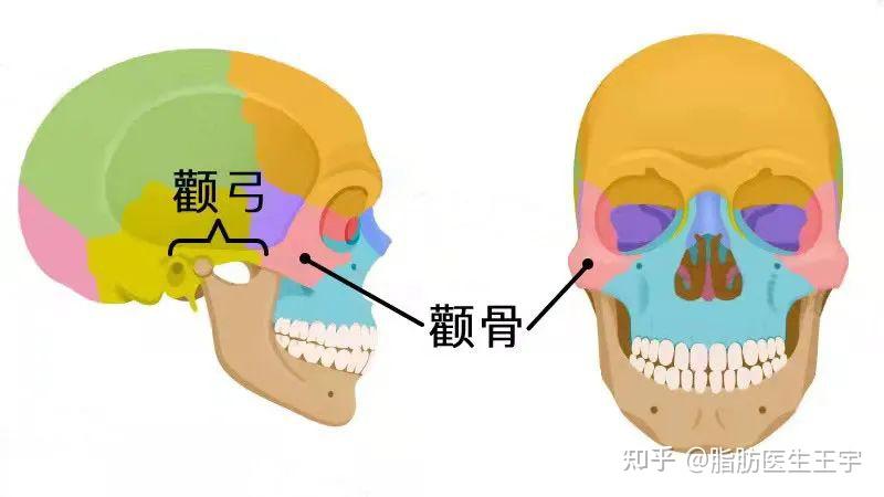 颧骨凸出？能用脂肪解决的问题别老想着动骨！ - 知乎