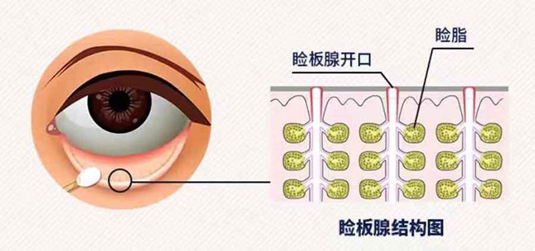 睑腺在哪图片