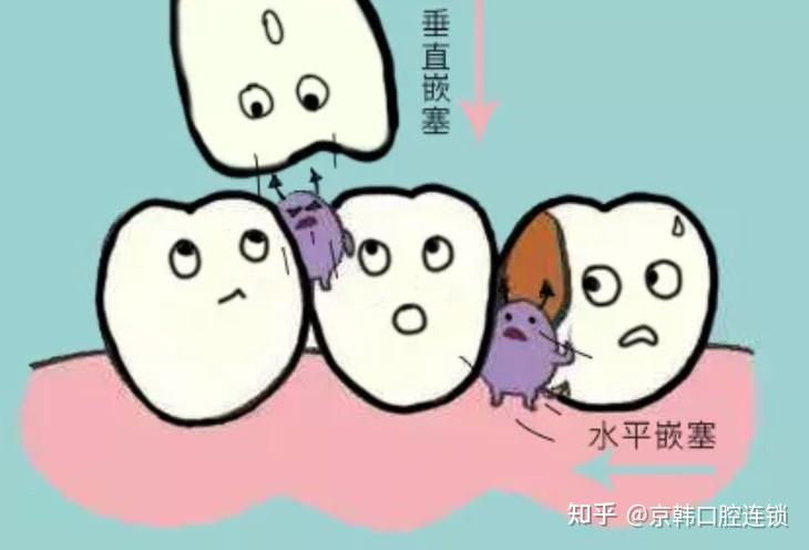 吃饭总塞牙可能是你的牙齿出现了问题