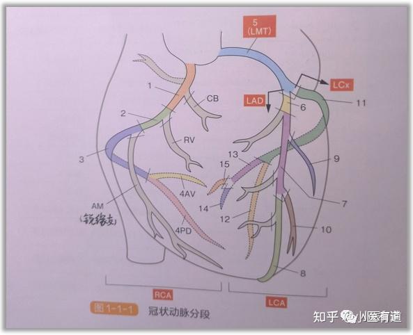 左前降支近段图片图片