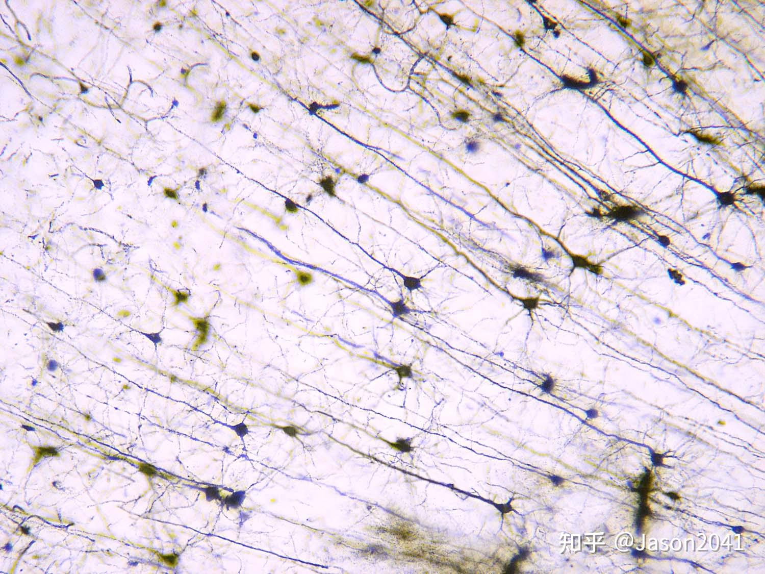 神经组织i-光镜下显示正常神经元和胶质细胞的方法