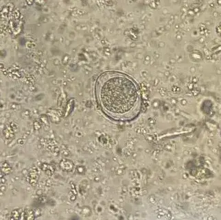 球虫显微镜下的图片图片