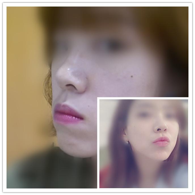 怎么看小孩子有没有地包天 v2-37202f3aea40af4675d9883f50c2656c_1440w.jpg?source=172ae18b