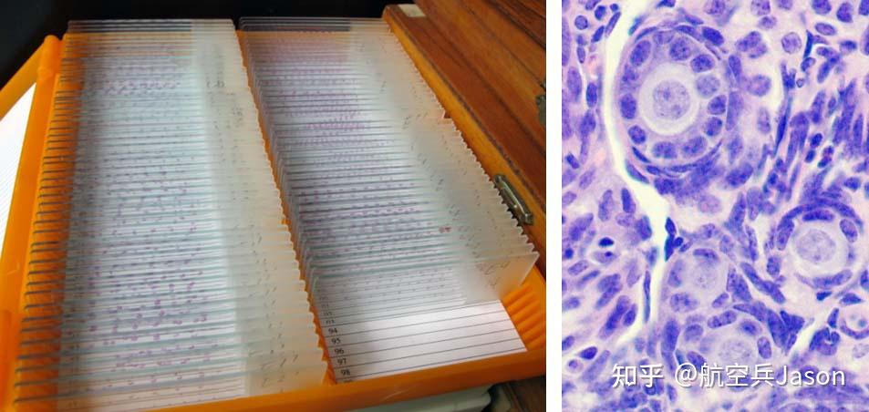 生物显微镜玻片标本是怎样制作的 - 知乎