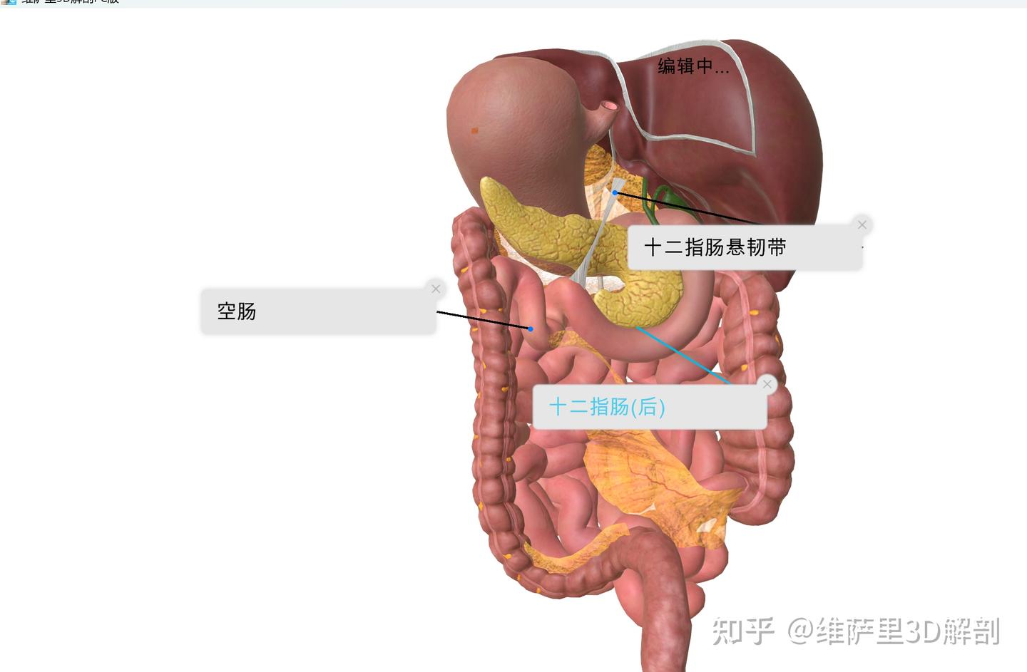 梗阻在哪?看一眼Treitz韧带就清楚 - 知乎